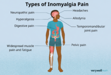 Inomyalgia