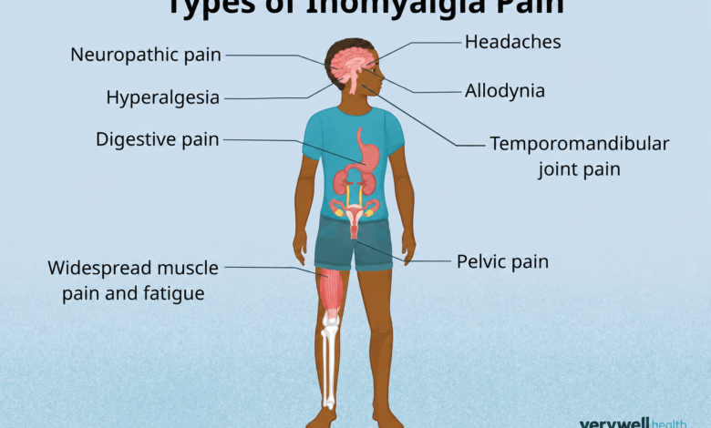 Inomyalgia